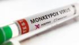 أوروبا تشتري لقاحات وأدوية جدري القرود بشكل جماعي