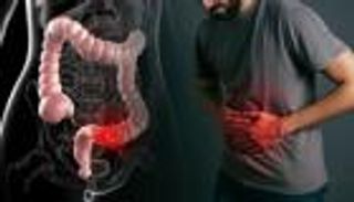 طرق علاج الإمساك المزمن.. وأبرز أسبابه وأعراضه