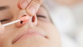 إزالة شعر الأنف