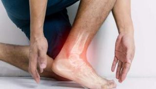 نوعية الغذاء لا تؤثر  تطور التهاب المفاصل