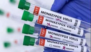 ارتفاع إصابات جدري القرود في بريطانيا