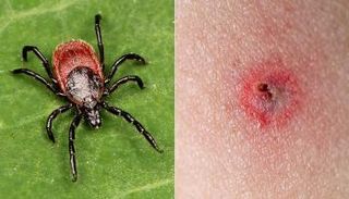 يمكن أن تؤدي عدوى الريكتسيا إلى مضاعفات تؤثر على القلب والأوعية الدموية 