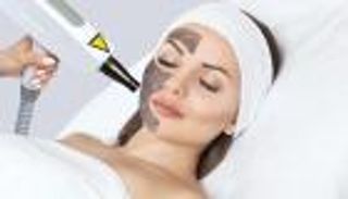 التقشير بالكربون.. مفتاح نقاء وشباب البشرة 