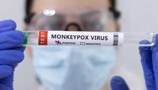 عينة إيجابية لجدري القرود - أرشيفية