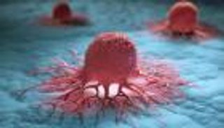 طفرة علمية.. باحثون يبتكرون مستشعرا نانويا يشخص السرطان مبكرا