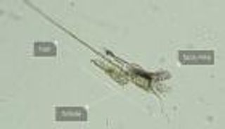 حقيقة علمية.. يوجد عناكب تعيش على وجهك لكنك لا تراها