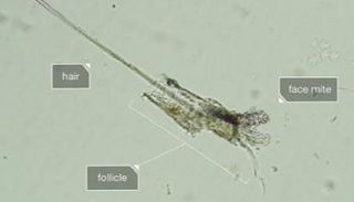 عثة الوجه تعيش داخل مسامك، فلا يمكنك غسلها