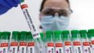 الصحة العالمية: تفشي جدري القرود مُقلق