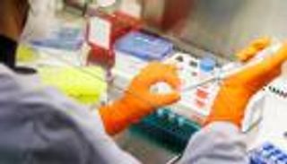 "الصحة العالمية" تلغي التمييز بين الدول بناءً على توطن جدري القردة.. ما السر؟