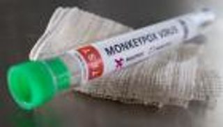 علاقة جنسية آمنة.. إرشادات جديدة لمرضى جدري القرود