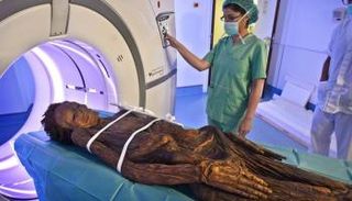 المومياوات حول العالم كشفت تاريخ الأمراض