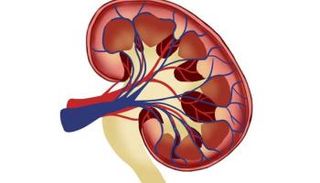 علاج جديد لنوع نادر من سرطان الكلى