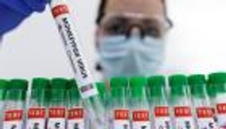 أمريكا توسع نطاق اختبارات جدري القرود مع زيادة الحالات