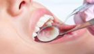 سرطان الفم.. الأعراض والعلاج ونسبة الشفاء