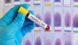 عدوى التهاب الكبد C.. إرشادات جديدة من "الصحة العالمية"