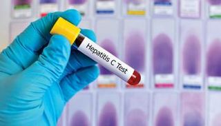 اختبار دم للكشف عن فيروس الكبد c