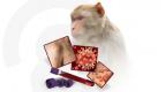 إنفوجراف.. أعراض جديدة غير متوقعة لجدري القرود 