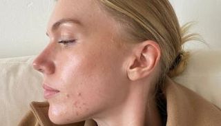 أعراض تحذرك من الجلوس كثيرًا