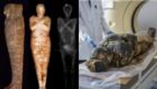 "السيدة الغامضة".. أول مومياء مصرية حامل ماتت بالسرطان