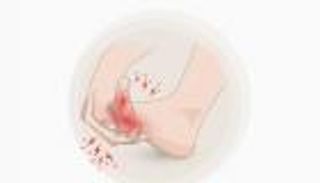 أسباب وطرق الوقاية من النقرس (إنفوجراف)