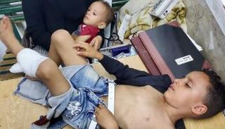 أحد الأطفال المصابين في المجزرة الحوثية بتعز