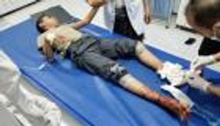 إدانة أممية لجريمة الحوثي بتعز: نرفض قتل الأطفال 