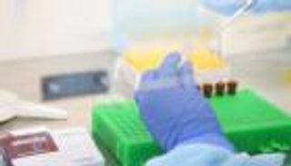 صفر إصابات بفيروس "سي".. هدف مغربي بحلول 2030