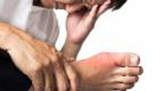 نوبات النقرس.. مضاعفات عديدة بينها السكتة الدماغية