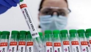 أمريكا تشهد تفشيا واسعا لجدري القرود