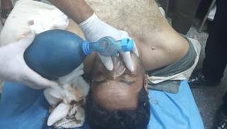 أحد المصابين يتلقى الإسعاف في أحد المستشفيات