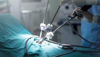 يجرى تنظير البطن تحت التخدير الكلي