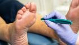 7 علامات على القدمين تشير إلى ارتفاع السكر في الدم