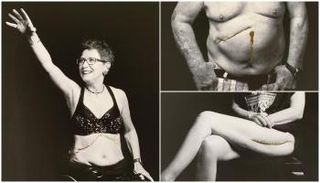 أعمال الفنانة والطبيبة البريطانية كارول هوليداي