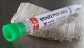 إندونيسيا تسجل أول إصابة بفيروس جدري القرود