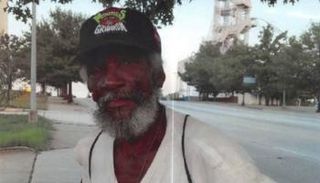 المتسول الذي أصيب بالشلل