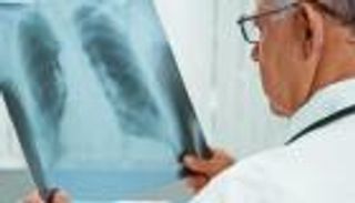 وفاة ثالثة جراء التهاب رئوي غامض في الأرجنتين