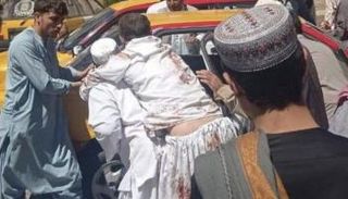 مواطنون ينقلون جرحى من مكان الانفجار