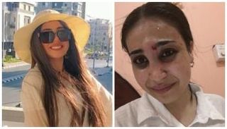 ريهام فتاة دكرنس قبل وبعد الاعتداء عليها