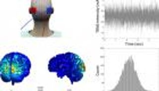 هل يمكن للضوضاء العشوائية أن تساعد على التعلم؟.. دراسة توضح