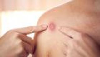 مع عودة المدارس.. نصائح لأولادك للوقاية من جدري القرود