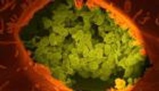 فيروسات مسببة للسرطان تثبط المناعة بمساعدة بكتيريا الأمعاء