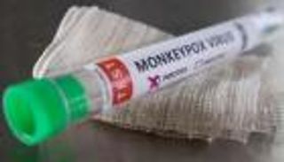 أوكرانيا تسجل أول إصابة بجدري القرود