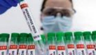 البحرين تعلن تسجيل أول إصابة بجدري القرود