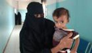 سوء تغذية أطفال اليمن.. عدو للصغار صنعته حرب الحوثي