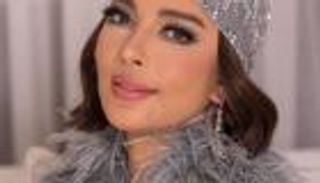 أصالة تكشف سبب تغير ملامحها في حفلها الأخير.. هل خضعت للتجميل؟