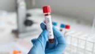 رجال ونساء وأطفال.. تونس تسجل 5400 مصاب بالإيدز