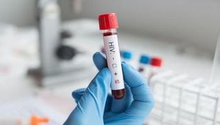 اختبار دم - تعبيرية