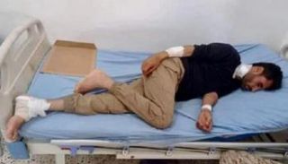 أحد الضحايا بهجمات مليشيات الحوثي