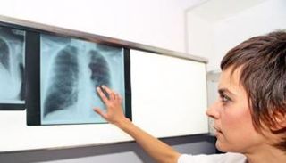 الالتهاب الرئوي ينتقل عن طريق الرذاذ