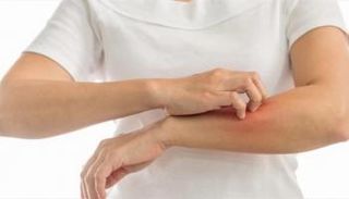 التهاب الجلد التأتبي ينتج عنه حكة واحمرار على سطح الجلد - أرشيفية